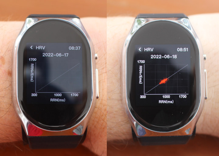 YHE BP Doctor Pro Blood Pressure Smart Watch Review