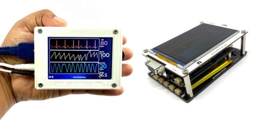 Standalone Vital Sign Monitor Standalone Vital Sign Monitor